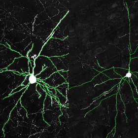 Circadian gene may be a key to humans’ unique cognitive abilities