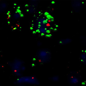 Brain signaling mechanism may explain clozapine weight gain