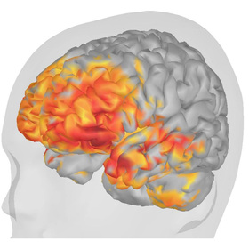 A MEG powerhouse: How UTSW is pushing the limits of brain research, care