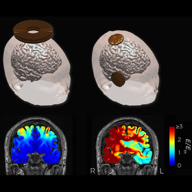 Experimental depression treatment preserves cognitive function