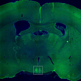 Neurons in brain’s timekeeper might control nighttime hunger