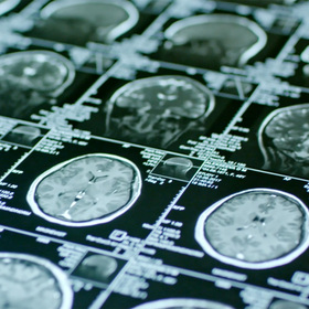New frontiers in neuroscience: 10 years of progress at UTSW’s O’Donnell Brain Institute