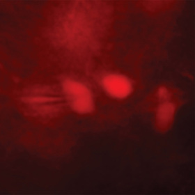 Study shows brain cells boost endurance benefits of exercise