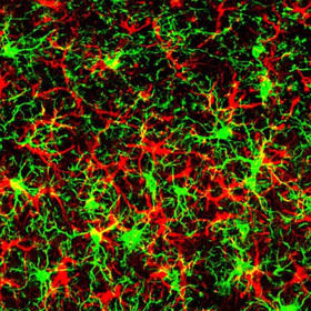 Scientists identify protein that heightens neurodegenerative disease