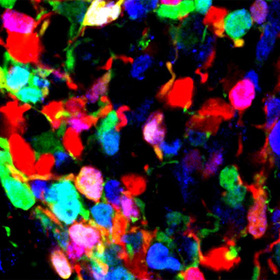 Developmental ‘switch’ in brain may shape lifelong obesity risk